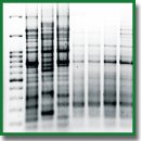 Molecular Typing of Uropathogenic Escherichia coli Strains Isolated from Patients by REP-PCR
